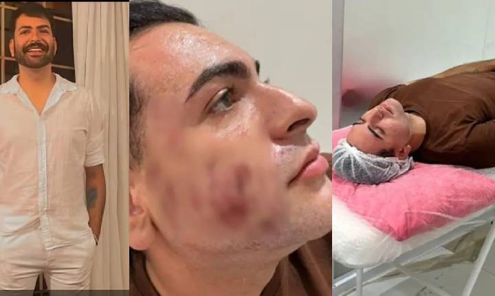 Empresário morre após peeling de fenol em São Paulo