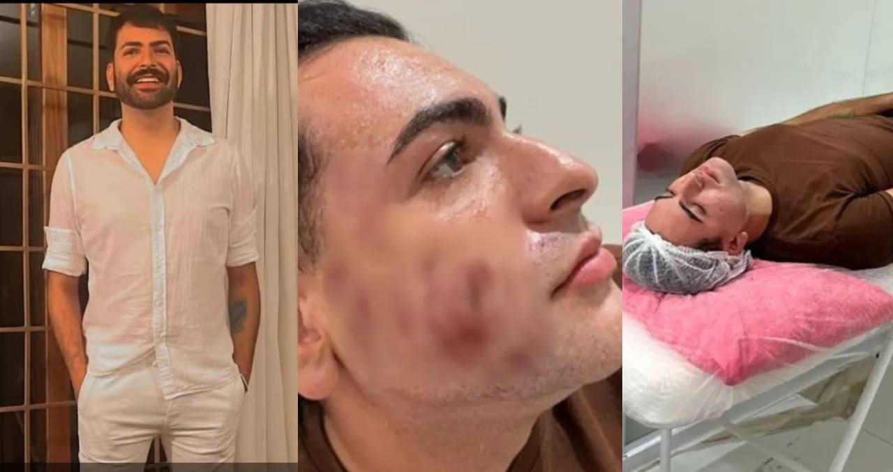 Empresário morre após peeling de fenol em São Paulo